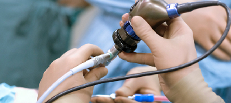 FESS Surgery Image 1