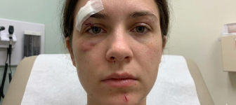 Endoscopic Sinus Surgery Malad