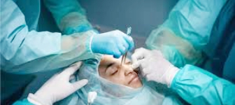 Endoscopic Sinus Surgery Malad