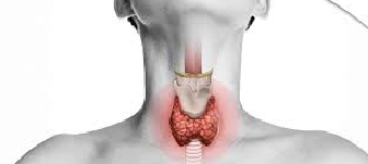 FESS Surgery Image 1